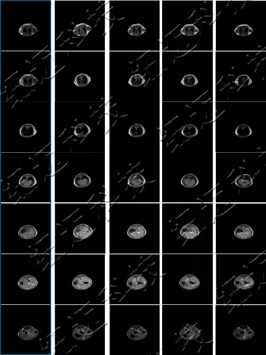 低場核磁共振技術(shù)在造影劑與動物成像中的應(yīng)用